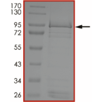 EGFR (T790M C797G L858R), Active